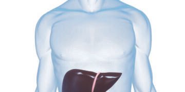 Hepatitis ما هو الألتهاب الكبدى الوبائى