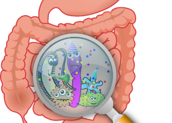 متلازمة القولون العصبي