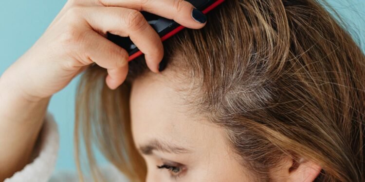 هل الأكسوزوم هو الحل للصلع الوراثى؟